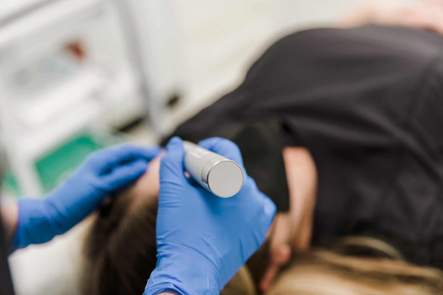 1. Microneedling Microneedling